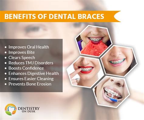 Top Benefits Of Dental Braces Dentistryondusk