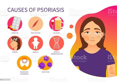 Vector Poster Causes Of Psoriasis Stock Illustration Download Image
