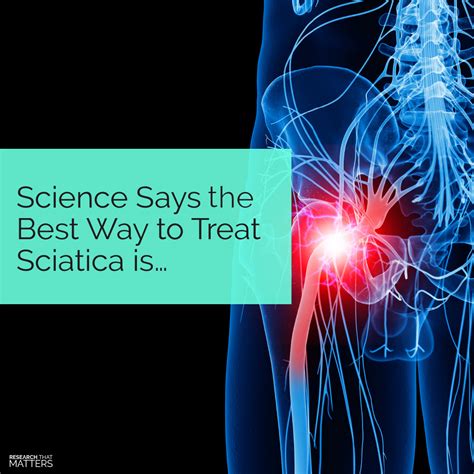 Science Says The Best Way To Treat Sciatica Is Huntsville Madison Alabama Chiropractor