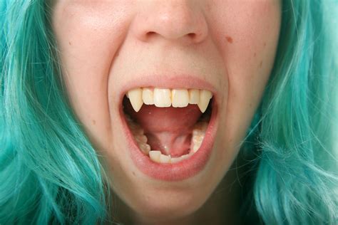 What Are Canine Teeth Called In Humans