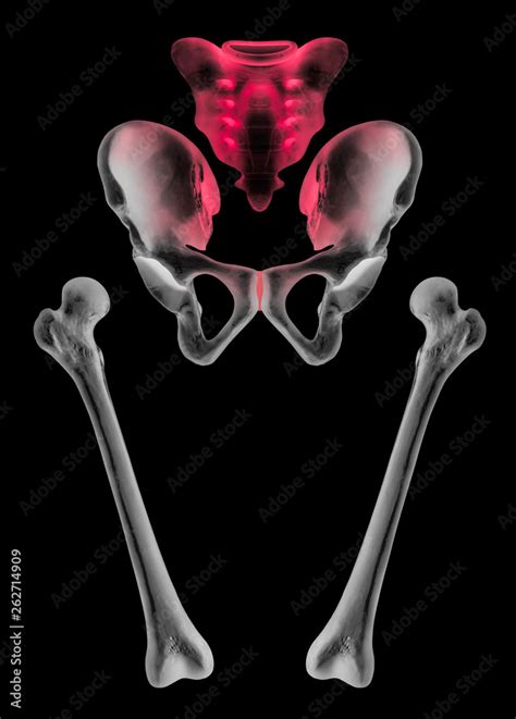 Leinwandbilder X Ray Of Separate Human Hip And Femur Bone Anterior View