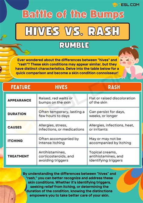 Hives Vs Rash Identifying The Key Differences • 7esl