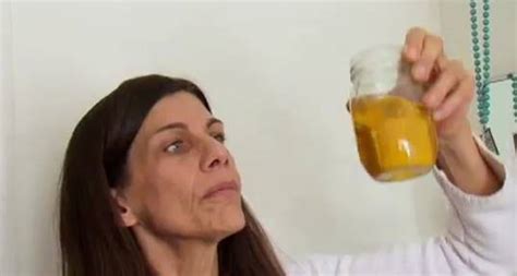 Woman Is Addicted To Drinking Her Own Urine Rtm Rightthisminute