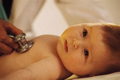 Kenali Dan Waspadai Terhadap Kondisi Bayi Kuning