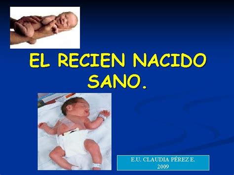 El Recien Nacido Sano E U Claudia Prez
