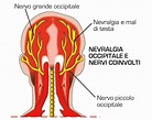 Nevralgia occipitale • Sintomi e Terapie • Medicina del Dolore