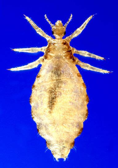 Free Picture Dorsal Female Body Louse Pediculus Humanus Corporis