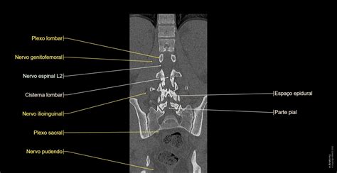 Coluna Vertebral Lombar Anatomia Normal E Anatomy