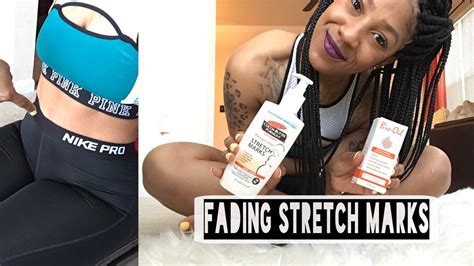 How To Fade Stretch Marks 4 Tips Youtube