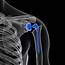 Should You Get Shoulder Replacement Surgery — THE SPORTS MEDICINE MINUTE