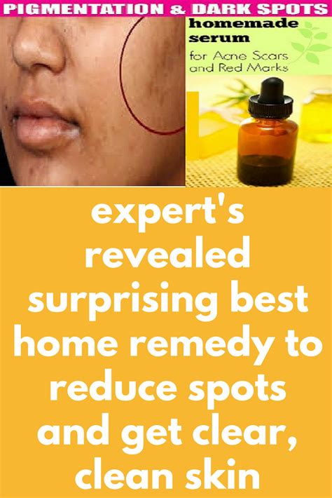 I am having white patch on both sides of mouth and feel pain on left side upto ear while opening mouth. expert's revealed surprising best home remedy to reduce ...
