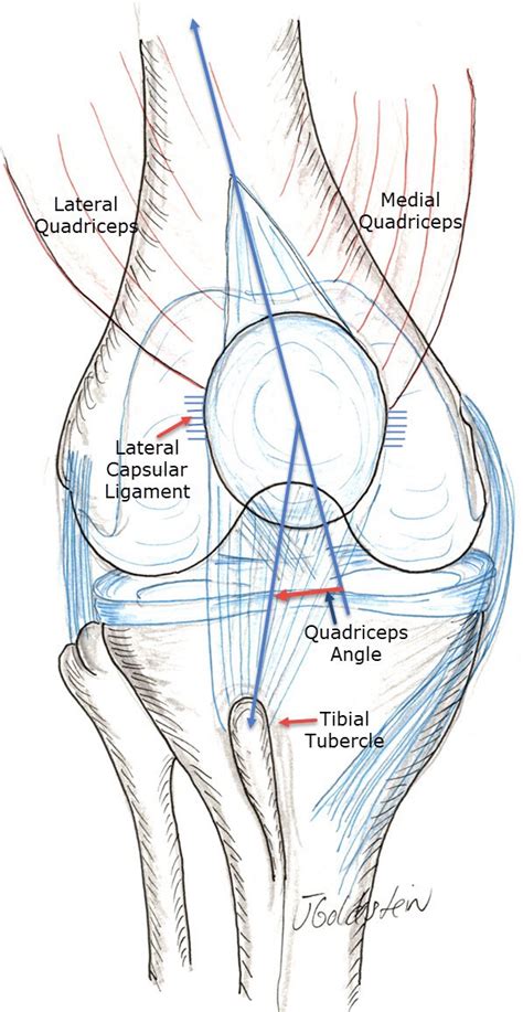 Knee Extensor Realignment Sports Medicine And Orthopedics