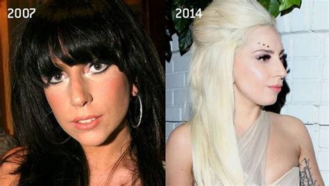 The Gradual Transformation Of Lady Gaga Before And After Plastic