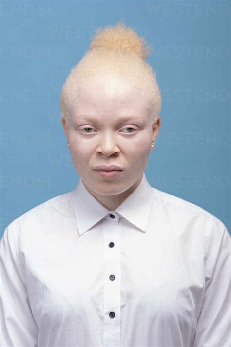 Albino Lady Telegraph