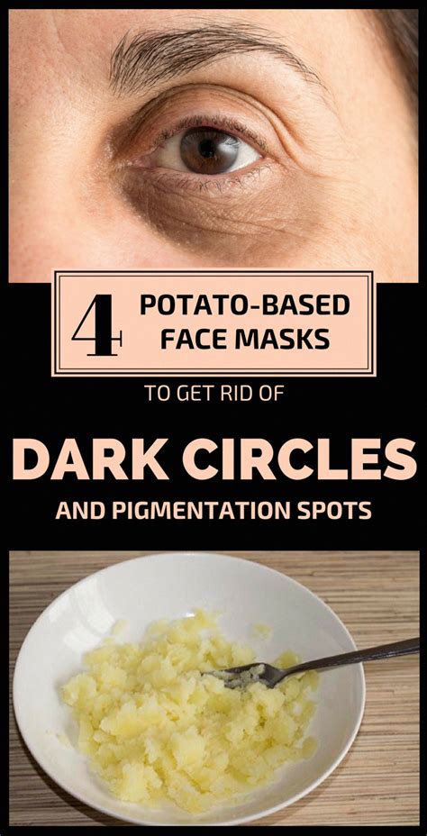 How To Get Rid Of Brown Spots On Face Whitedeerwithbrownspots