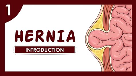 01 Abdominal Hernia Introduction Youtube