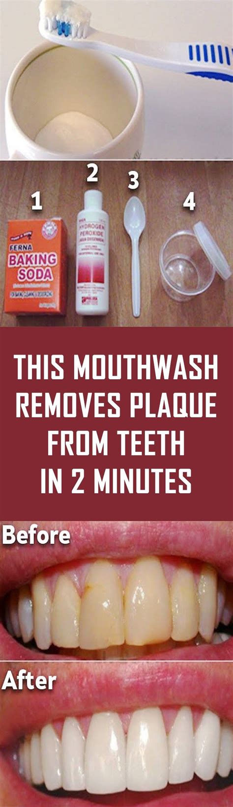 this mouthwash removes plaque from teeth in 2 minutes homemade