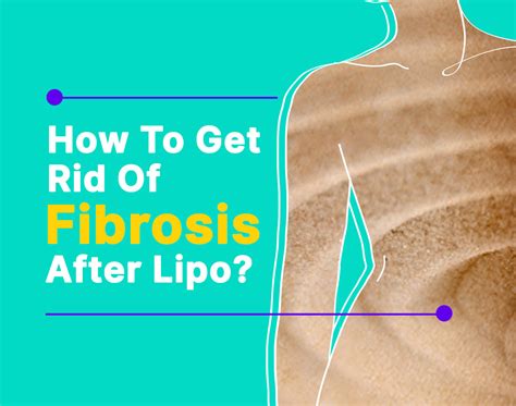 How To Get Rid Of Fibrosis After Lipo Carefultrip