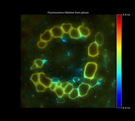 Fluorescence Lifetime Imaging Microscopy Flim Camera