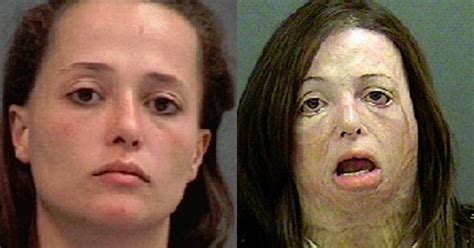 Top 10 Shocking Before And After Drug Use Photos Video Blog Evadează