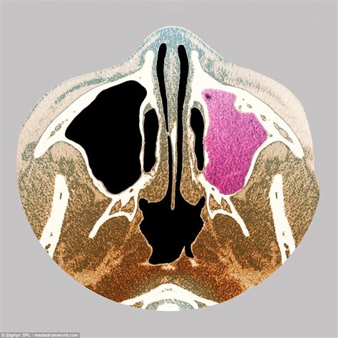 Fascinating Medical Scans Reveal The Intricate Workings Of The Human