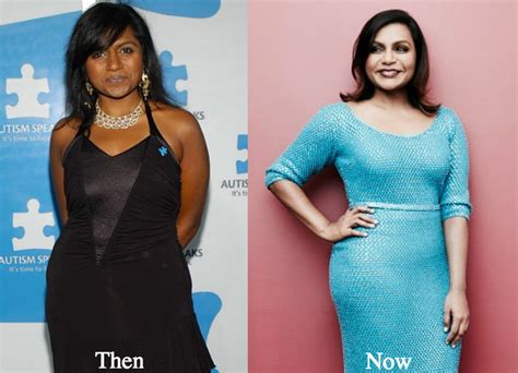 Mindy Kaling Plastic Surgery Before And After Photos Latest Plastic