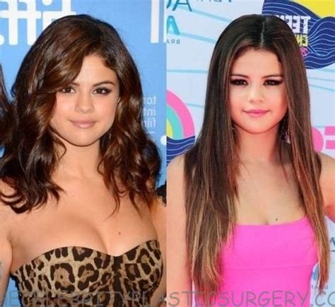pin on selena gomez plastic surgery before and after