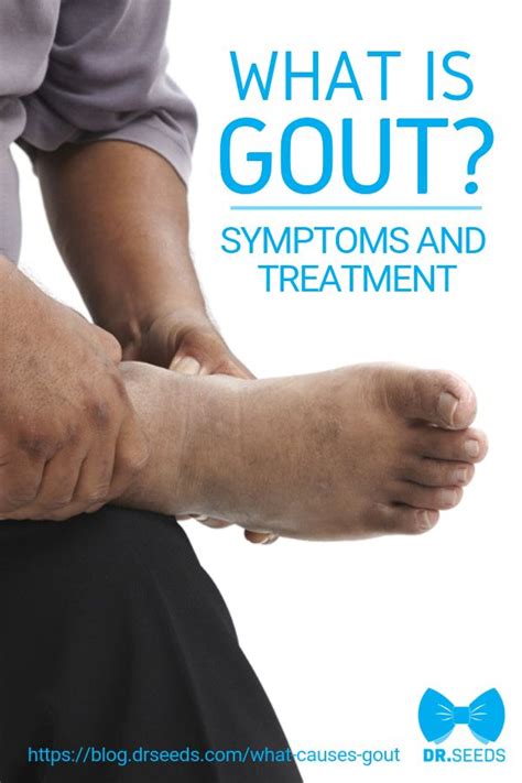 How Does Gout Affect The Feet Goutinfoclub Com