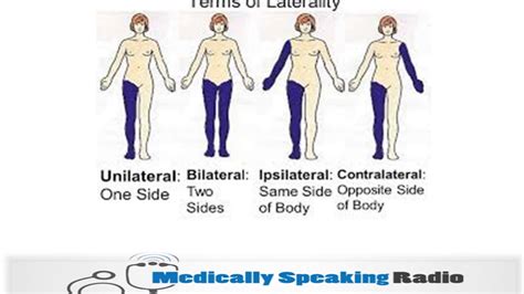 Medicallyspeakingterms Of Laterality Youtube