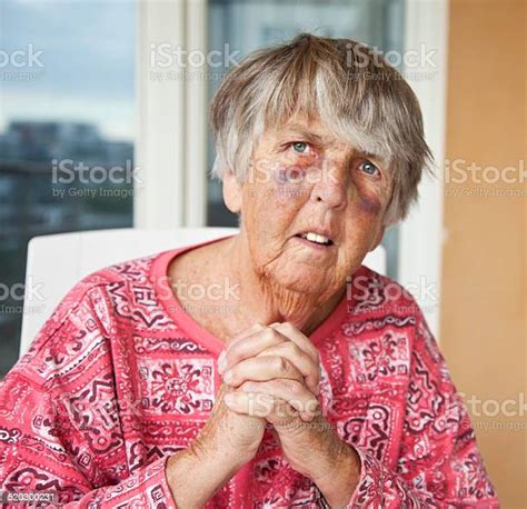 Close Up Of Begging Battered Senior Woman With Bruises Stock Photo