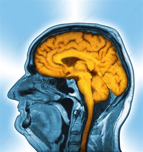 Normal Brain Mri Scan Stock Image P3320497 Science Photo Library