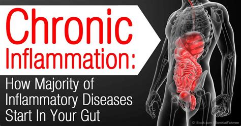 Inflammation The Prerequisite To Disease 302 Medici Enterprises