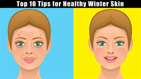 Top 10 Tips For Healthy Winter Skin Youtube