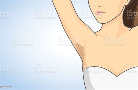Armpit Skin Discoloration Stock Illustration Download Image Now