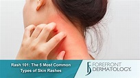 Rash 101: The 5 Most Common Types of Skin Rashes - DermSpecialists