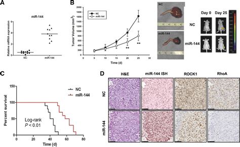 mir 144 inhibits tumor growth and metastasis in osteosarcoma via dual suppressing rhoa rock1
