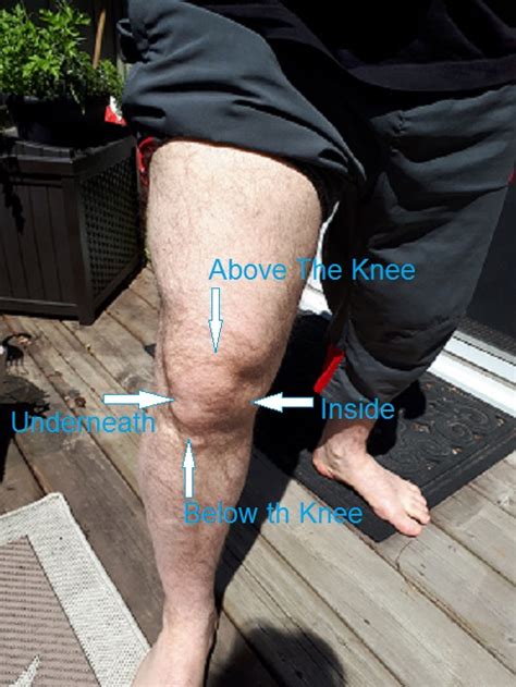 昔はお前のような冒険者だったが、膝に矢を受けてしまってな….be taking an arrow (or some variation thereof) in the knee doesn't mean it refers to this meme. Knee Soreness - Assess Hip and Foot - Mike Grafstein ...