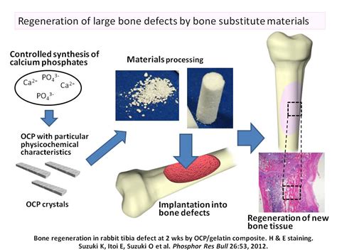 Research Profile 178 Development Of Novel Bone Substitute
