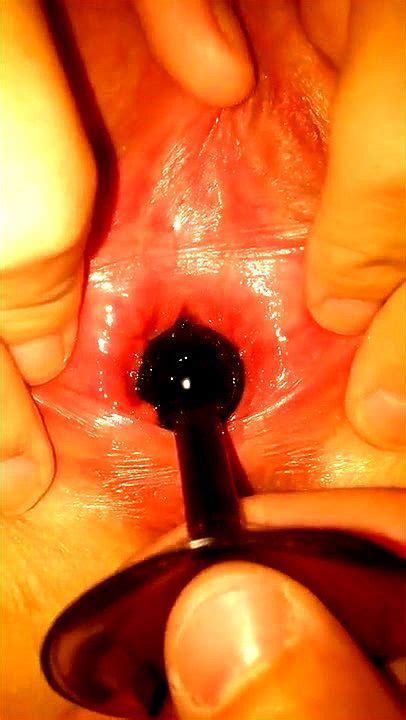 watch anal bead peehole urethra beads urethra insertion porn spankbang