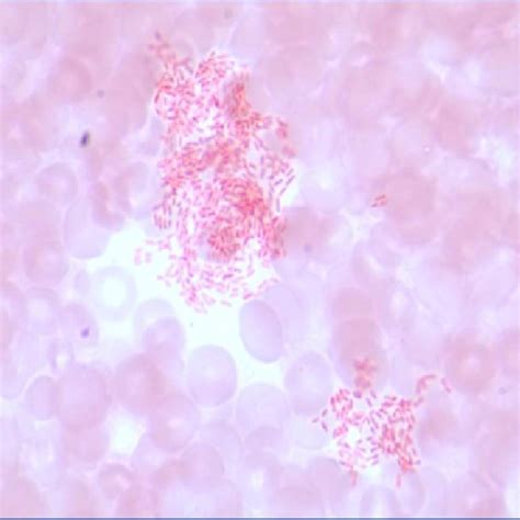 Gram Stain Of Blood Showing Gram Negative Bacilli In Clusters