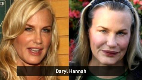 Celebrity Plastic Surgery Disasters Youtube