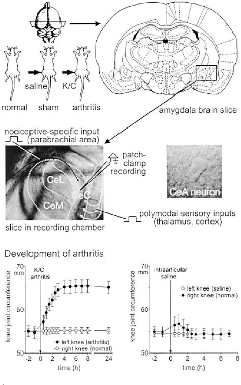 Synaptic Plasticity In The Amygdala In A Model Of Arthritic Pain My
