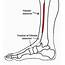 Tibialis Anterior Tendinopathy  Ankle Foot And Orthotic Centre
