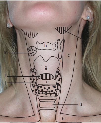 Throat anatomy understanding the basics of it with diagrams. Landmarks of the Throat Area | Crazy Medicine | Medical ...