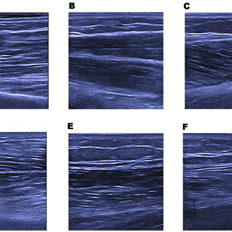 Example Of Muscle Ultrasound Images A Biceps Brachii B Wrist