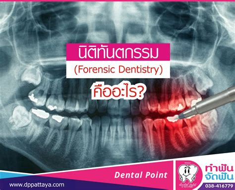 นิติทันตกรรม(Forensic Dentistry) คืออะไร? | คลินิกทำฟันพัทยา Dental Point