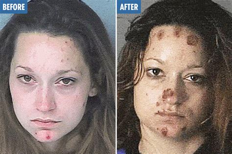 Shocking Mugshots Reveal Rapid Transformations Of Long Term Drug Abuse