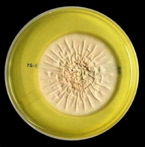 Acremonium Spp Su Saboraud Dextrose Agar Fungi Petri Dishes