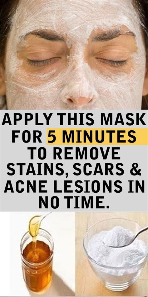 Apply This Baking Soda And Honey Mask On Your Face And See What Will Happen After Minutes