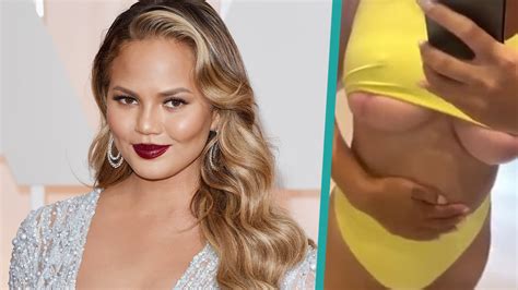 Chrissy Teigen Proves She Had Breast Implants Removed By Showing Scars